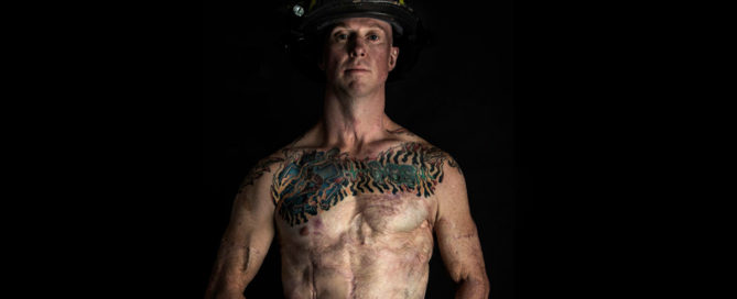 Devin Barnhart burn survivor, firefighter, SOTF, task force leader featured image