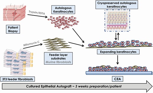 Graphical schematization of cultured epithelial autograft (CEA) GMP manufacture. An epidermal biopsy of healthy skin is harvested from the patient and enzymatically dissociated (trypsin 0.1%, mechanical agitation at 37°C, filtration on 100 µm cell strainers). Confluent 3T3-J2 murine fibroblasts are growth-arrested by adjunction of mitomycin C (4 µg/ml) and are used as feeder layers for coculture proliferation support. Keratinocytes are grown in culture medium composed of DMEM, HAM’s F12, FBS, l-glutamine, EGF, hydrocortisone, cholera toxin, penicillin–streptomycin, insulin, and gentamycin. After expansion of sufficient keratinocyte populations (around 60% confluence), cells may be harvested in sheets for CEA preparation (dispase 0.25% treatment) or harvested (trypsin–EDTA, 0.05–0.01%) and suspended in cryopreservation medium (BIOFREEZE) and frozen for long-term storage. After incubation, cell sheets are rinsed with DMEM supplemented with penicillin–streptomycin. For transfer to the clinic, constructs are mechanically transferred and clipped onto Vaseline gauze (7.6 cm × 23 cm) and immersed in rinsing medium supplemented with gentamycin. The different manufacturing steps result in a production delay of about 3 weeks for a given patient before the autografts are available for therapeutic use.