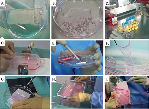 Graphical illustration of various manufacturing steps of cultured skin autograft (CEA or CDEA) manufacture. (A) A full-thickness 10 sq cm2 biopsy is procured. (B) Patient dermal fragments are minced and cell cultures are initiated using seeding for keratinocytes or an explant method for fibroblasts. (C) Cells are culture expanded and harvested with trypsin–EDTA (0.05–0.01%). (D) Culture flasks are cut for stratified cell sheet harvest. (E and F) Cell sheets are carefully removed from the culture vessels. (G) Cell sheets are adjusted on adequate Vaseline gauze to form CEAs or CDEAs. (H) Sheets are put into square flasks contain a small quantity of medium and conditioned into a hermetic box (as secondary containment) for transport. (I) CEAs or CDEAs are processed for clinical application in the operating theater. CDEA, cultured dermal–epidermal autograft; CEA, cultured epithelial autograft.