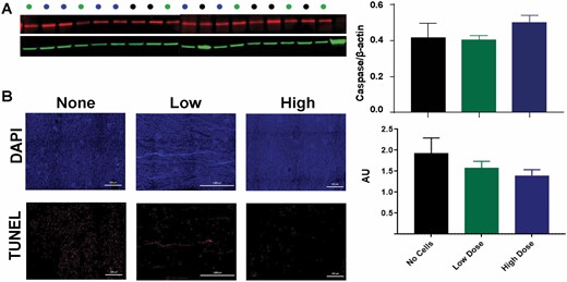 Apoptosis in the kidney. Caspase-3 levels in kidney lysates via Western blot (A) and TUNEL staining in kidney tissue slices via immunohistochemistry (B) were quantified for each treatment group detected at 24 hours postburn, but did not reveal any significant differences. Data points for (A) and (B) are presented as mean ± SEM.