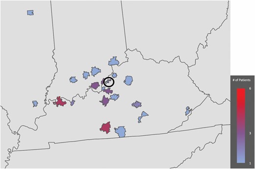 Distance from transferring facilities. Circle denotes county of burn center.